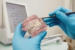 Liga Acadêmica de Odontologia promove aula aberta sobre Ortodontia